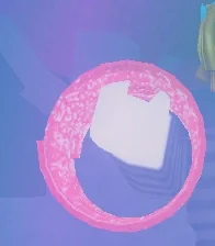 Semi-Speedcoil